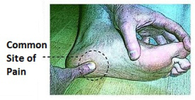 Heel Pain