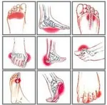 foot pain symptoms 304 opt oct18