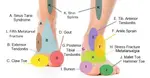 front top foot pain diagram nov 24