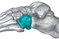 Cuboid syndrome classically presents with pain on outside of foot