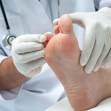 Athlete's Foot Symptoms & Diagnosis. Common causes and treatment of ringworm on foot Athlete's Foot Symptoms & Diagnosis. Common causes and treatment of ringworm on foot