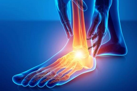 How to Treat and Prevent Foot Pain from Walking or Standing