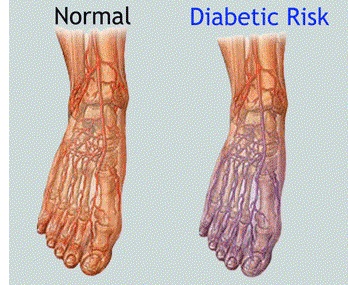 Nerve Endings In Feet Chart