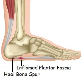 pain in bottom of foot and calf