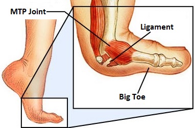 Why Foot Ligament Pain Occurs - Neuragenex