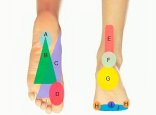 Schema di diagnosi del dolore al piede - un ottimo strumento per aiutarti a capire cosa sta succedendo