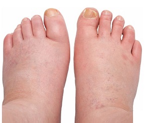 Foot Pain Symptoms How To Treat Them Foot Pain Explored