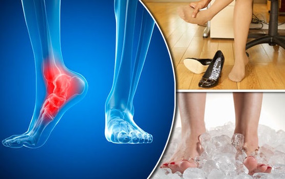 Foot, Ankle, Heel, Toe, Bone; Pain & Spur Treatments Singapore