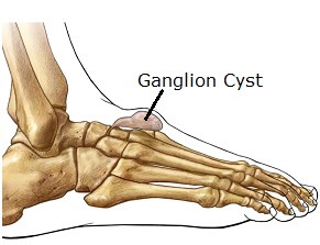 Pain on of Foot: Symptoms &