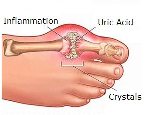 big toe and heel pain