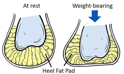 Heel Fat Pad: A specialized layer of fatty tissue that protects the heel. It is compressed and provides cushioning when weight-bearing through the foot.