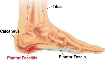 Foot and Ankle Pain - Singapore-totobed.com.vn