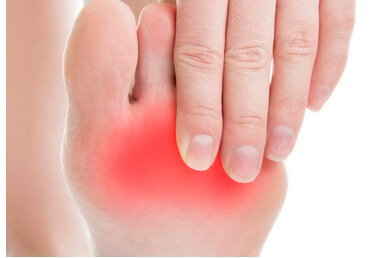 Mortons neuroma symptoms typically include pain, tingling and numbness around the ball of the foot and toes. Find out about the causes, symptoms & treatment options Mortons neuroma symptoms typically include pain, tingling and numbness around the ball of the foot and toes. Find out about the causes, symptoms & treatment options