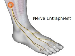 swollen top of foot causes