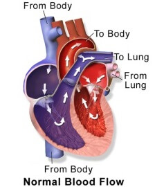 If there is a problem with how the heart pumps, fluid seeps out of the blood vessels into surrounding tissues and can cause foot and ankle swelling