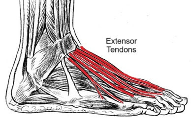 Extensor tendonitis is a common cause of pain on top of the foot. Find out about the causes, symptoms and treatment options