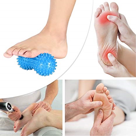 Treatment Plantar Fasciitis Foot Explored