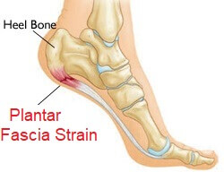 back of heel tender to touch