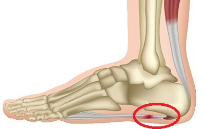 pain under heel of foot