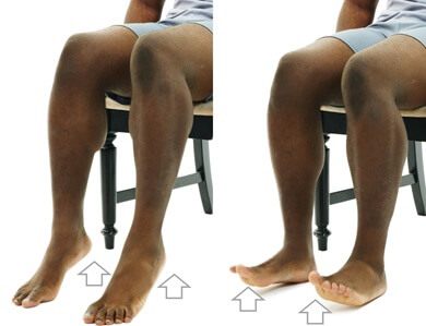 Simple exercises can help to reduce the symptoms of red feet