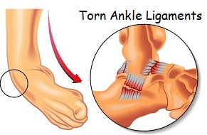pain on left side of heel when walking