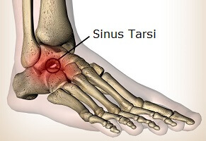 Pain on of Foot: Symptoms &