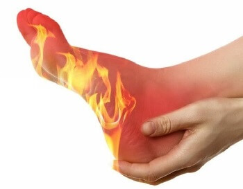 Burning Foot Pain: Causes, Diagnosis & Treatment - Foot Pain Explored