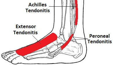 Foot Tendon Chart