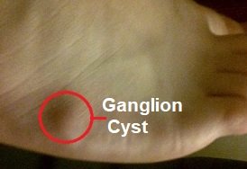 size vagina Pea lump deep in size vagina Pea lump deep in